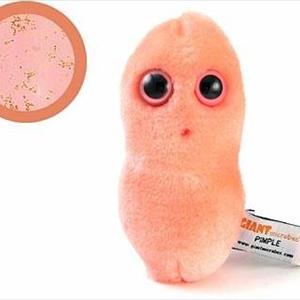 Mononucleosis Infection - EBV Infectious Mononucleosis, Kissing Disease Mono